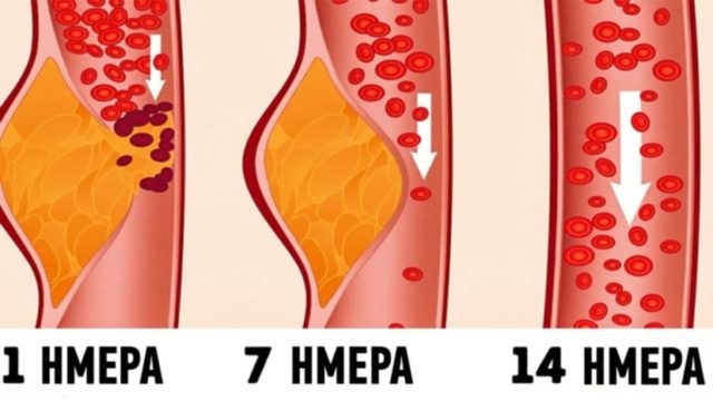 Τι είναι η δίαιτα ΝΤΑΣ και γιατί οι γιατροί τη θεωρούν μια από τις καλύτερες για την υγεία μας