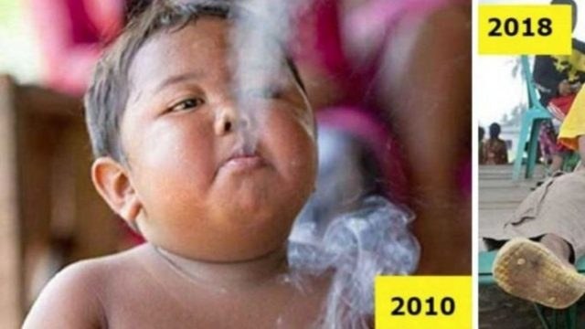 Θυμάστε το παχύσαρκο νήπιο που ήταν εθισμένο στο κάπνισμα; Δείτε πως είναι σήμερα και θα πάθετε πλάκα!