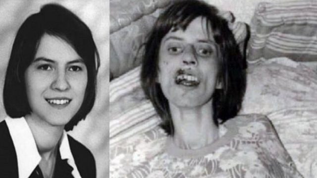 Πέθανε μετά από 67 συνεχόμενους εξορκισμούς. Η «υπόθεση της Ανελίζε» που αναστάτωσε τη Γερμανία και έγινε ταινία