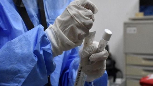 Κορωνοϊός: Νέα μέθοδος ανίχνευσης το ίδιο αξιόπιστη με τα PCR τεστ – Δίνει απάντηση σε μόλις 4 λεπτά!