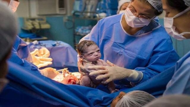 Αυτό το μωρό έγινε viral αμέσως μετά την γέννησή του – Δείτε την συγκλονιστική έκφρασή του