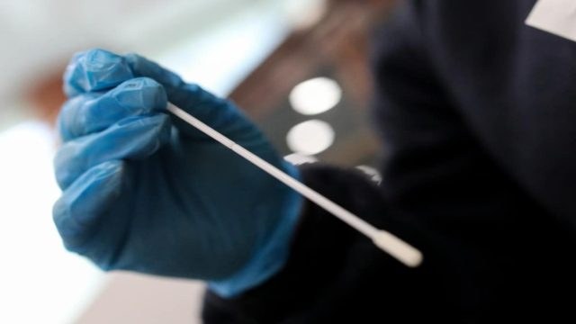 Κορωνοϊός 26/4: Παραμένουν πάνω από τους 40 οι νεκροί – Κομμένα… στη μέση τα κρούσματα