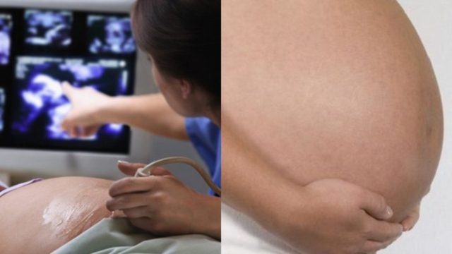 17χρονη νόμιζε ότι ήταν έγκυος – Μόλις πήγε στο γιατρό αντίκρυσε κάτι σοκαριστικό