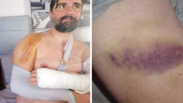 «Λεπτή η γραμμή μεταξύ ζωής και θανάτου» – Σοκάρουν οι φωτογραφίες από τον ξυλοδαρμό διασώστη του ΕΚΑΒ