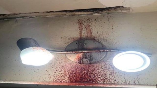 Άρχισε να τρέχει αίμα από το ταβάνι του μπάνιου του…Αυτό που είχε συμβεί στον πάνω όροφο θα σας σοκάρει!