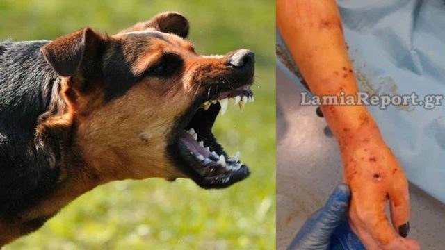 Τρόμος στην Λαμία: Άγρια επίθεση σκύλου σε 35χρονη – Μήνυση στον ιδιοκτήτη του ζώου θα υποβάλλει το θύμα