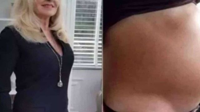 66χρονη φτάνει στο νοσοκομείο πιστεύοντας πως είναι έγκυος – Όταν οι γιατροί της λένε την αλήθεια «παγώνει»