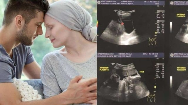 Έγκυος στα 44 μετά από 10χρονη μάχη με τον καρκίνο – Χαμογέλασε ξανά!