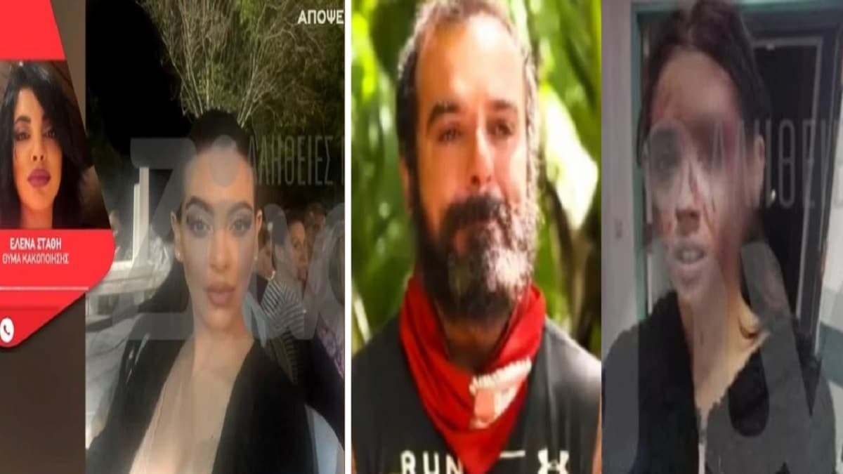 «Με άρπαξε από τα μαλλιά και… Με το άλλο χέρι…» – Μετά την βαφτιστήρα του Τριαντάφυλλου και άλλη κοπέλα καταγγέλει ξυλοδαρμό από τον ίδιο άντρα (Video)