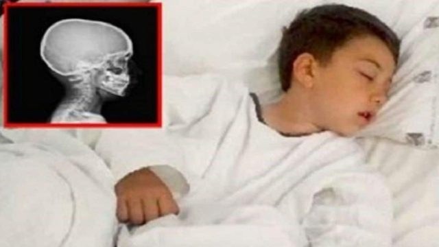 Έψησε ένα μπιφτέκι να φάει ο γιος της που πεινούσε! Λίγη ώρα αργότερα, έτρεχαν στα επείγοντα…