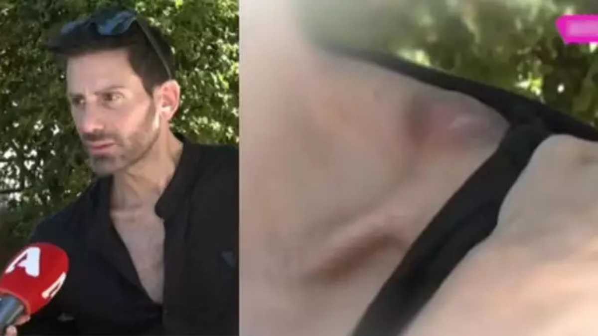 Γενναία μάχη για τον Νίκο Φλωρινιώτη: «Οι γιατροί μου είπαν δεν ξέρουν αν θα ζήσω» – Οι φρικτοί πόνοι και οι παρενέργειες