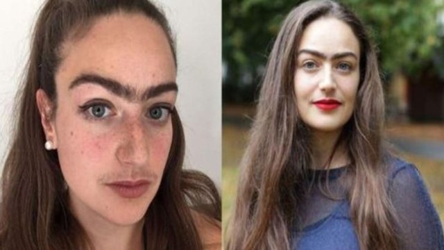Η 31χρονη που σταμάτησε να βγάζει φρύδια και μουστάκι γιατί νιώθει θηλυκή ακόμη και με τις τρίχες της