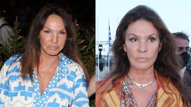 «Κόλαφος» η Βάνα Μπάρμπα: Απαντά στην καταγγελία της ΠΟΕΔΗΝ ότι διέσπειρε τον κορωνοϊό σε νοσοκομείο