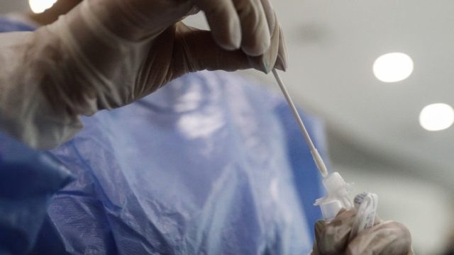 «Σαρώνει» ο κορωνοϊός στην Ελλάδα: Στις 771 οι νέες εσαγωγές – Ο ΕΟΔΥ τονίζει την προσοχή στις ευάλωτες ομάδες