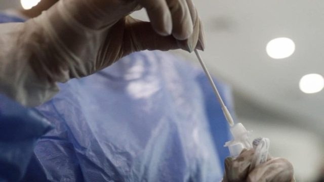 ΕΟΔΥ: Κρούει «καμπανάκι» – Αύξηση στις σοβαρές νοσηλείες από COVID-19 και γρίπη