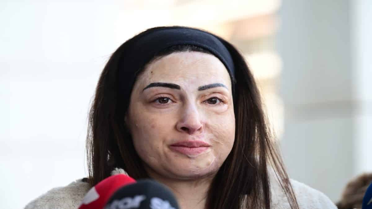 Ιωάννα Παλιοσπύρου: Η ζωή της και η επίθεση με βιτριόλι έγιναν ντοκιμαντέρ – Στόχος να ταξιδέψει στο εξωτερικό