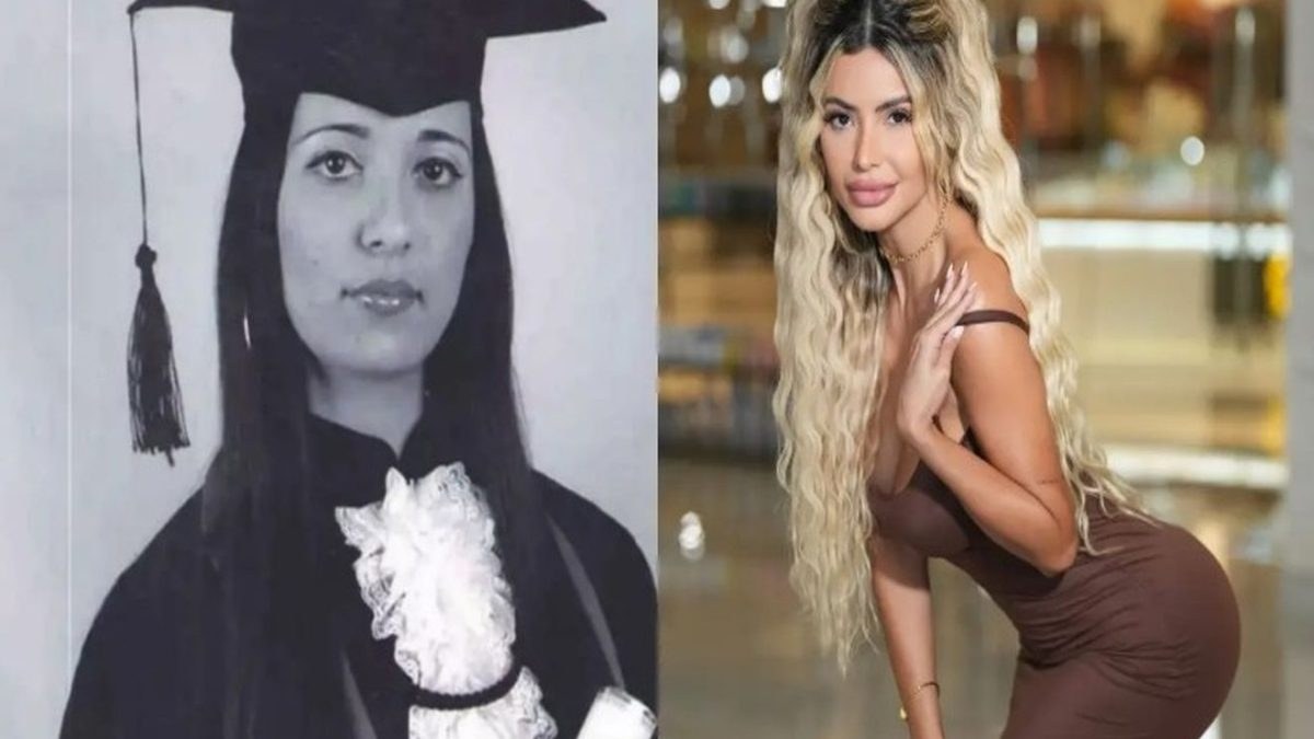 Πλαστικές Βραζιλιάνα