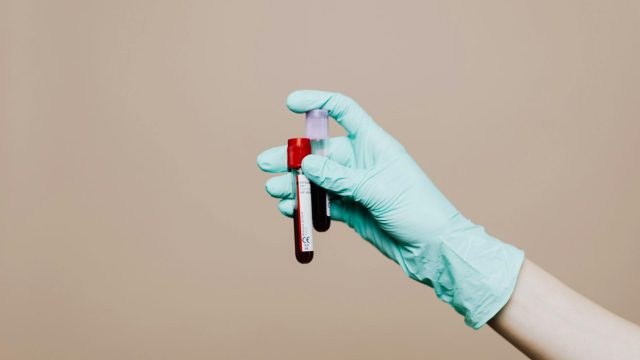 Εγκεφαλικό: Αν έχεις αυτή την ομάδα αίματος κινδυνεύεις περισσότερο