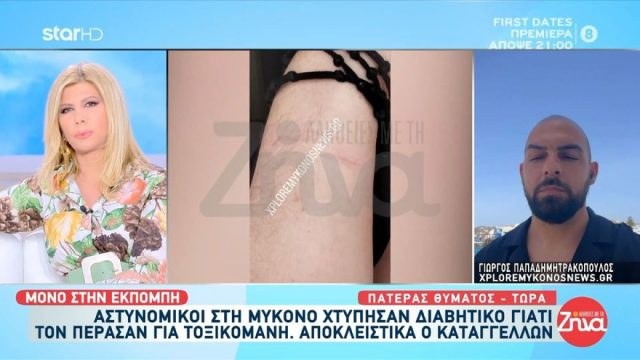 Καταγγελία σοκ στη Μύκονο: Διαβητικός ξυλοκοπήθηκε από αστυνομικούς – Τον πέρασαν για χρήστη ναρκωτικών