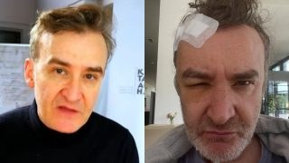 Νίκος Ορφανός: Χειρουργείο για όγκο στον εγκέφαλο για τον γνωστό ηθοποιό – Η περιπέτεια που κανείς δε γνώριζε