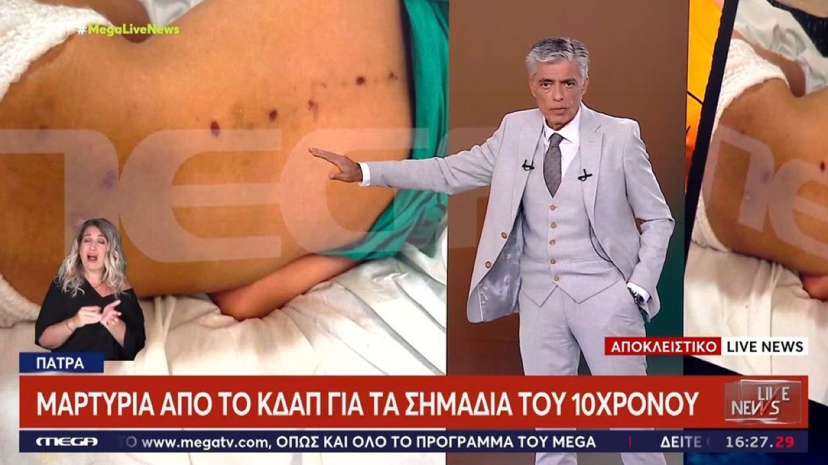 «Φανταστείτε να κακοποιείται εκτός οικογένειας»: Σε διαφορετικό χρόνο έγιναν τα σημάδια στο σώμα του 10χρονου ΑμεΑ