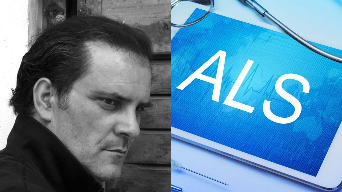 ALS: Τι είναι η νόσος της αμυατροφικής πλευρικής σκλήρυνσης από την οποία έπασχε ο Μιχελής – Τα συμπτώματα και η εξέλιξή της