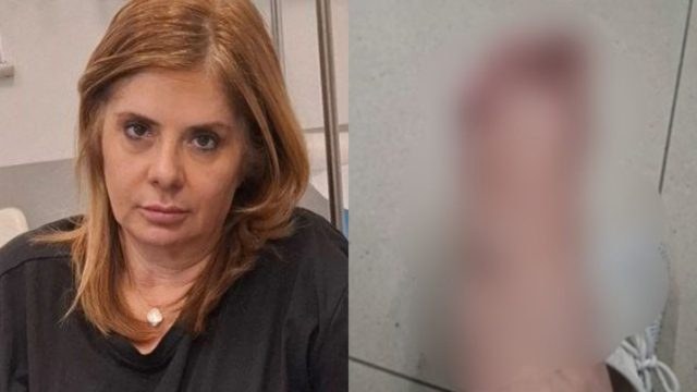 Σοκάρει η Βάσια Παναγοπούλου για το ατύχημά της: «Θα μπορούσα να έχω σκοτωθεί – Με ανάγκασαν να περπατάω 12 λεπτά με κάταγμα»