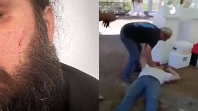 Ξεσπά ο ιερέας μετά τον ξυλοδαρμό στην Καρδίτσα: «Εγώ απλά αμύνθηκα, ο Θεός και ο Αϊ Λιάς τα είδε»
