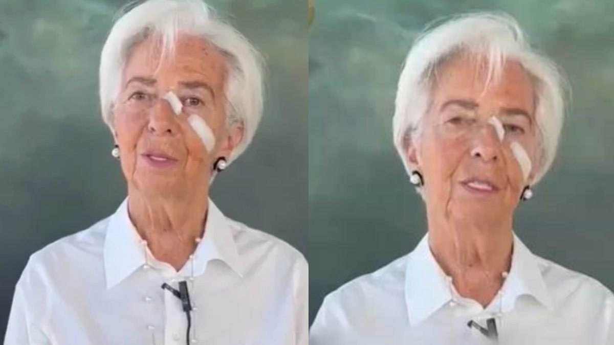 Το αποκάλυψε η Λαγκάρντ: Με τσιρότα στο πρόσωπο ανακοίνωσε την παραίτησή της και μίλησε για τον καρκίνο