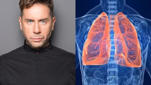Μαζωνάκης: Τι είναι το πνευμονικό οίδημα που έδειξε η ιατροδικαστική – Πώς γεμίζουν οι πνεύμονες με υγρό, πότε απειλείται η ζωή