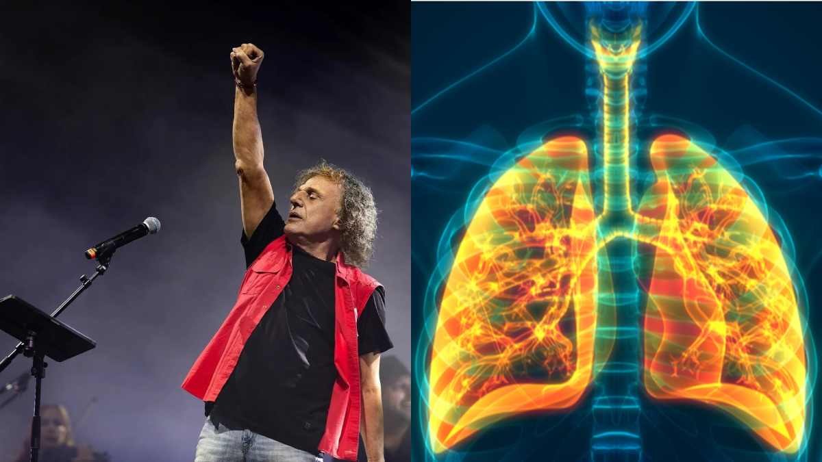 Τι είναι η ασθένεια ΧΑΠ από την οποία πάσχει ο Βασίλης Παπακωνσταντίνου – Τα συμπτώματα και η διάγνωση